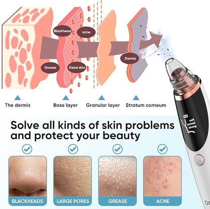 Pistola Limpiadora  Facial de Poros